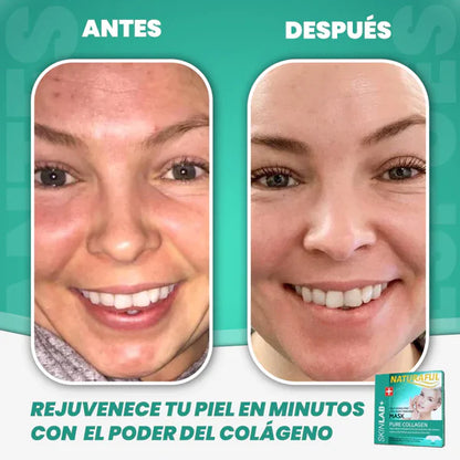 DermiFusion®| Mascarilla Colágeno Rostro Completo